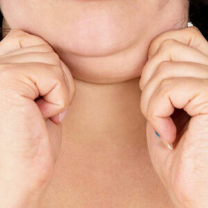 Struggling with a double chin? Here’s how you can get rid of it