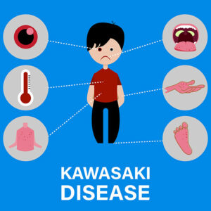 Kawasaki disease – causes and symptoms